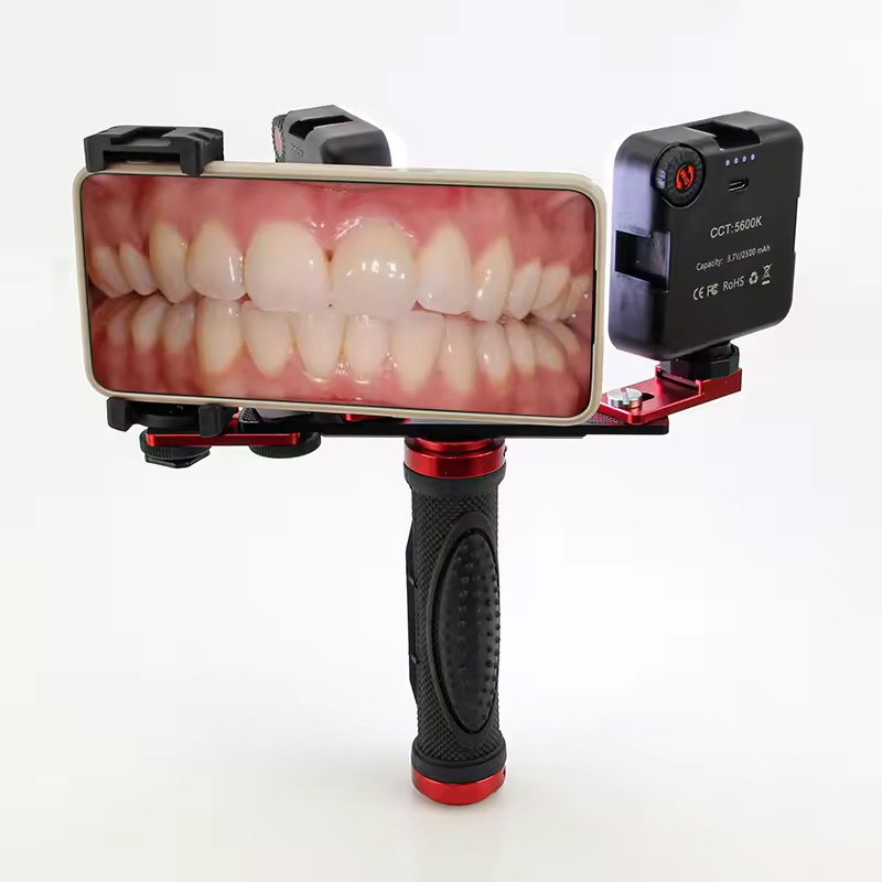 Photography Dental - Dental Mobile Photography LED Light Intraoral
